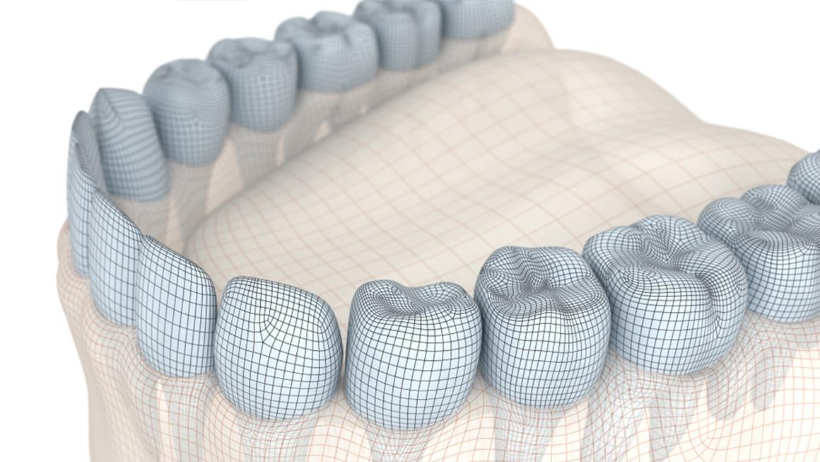 Digital Surgical Guide